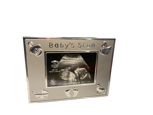 Baby Scan Keepsake Frame